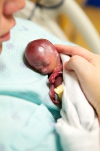 Walter Le bebe dont les photos changent le debat sur l avortement (2)