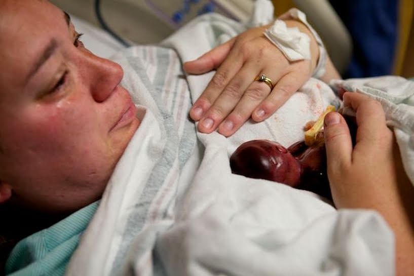 Walter Le bebe dont les photos changent le debat sur l avortement